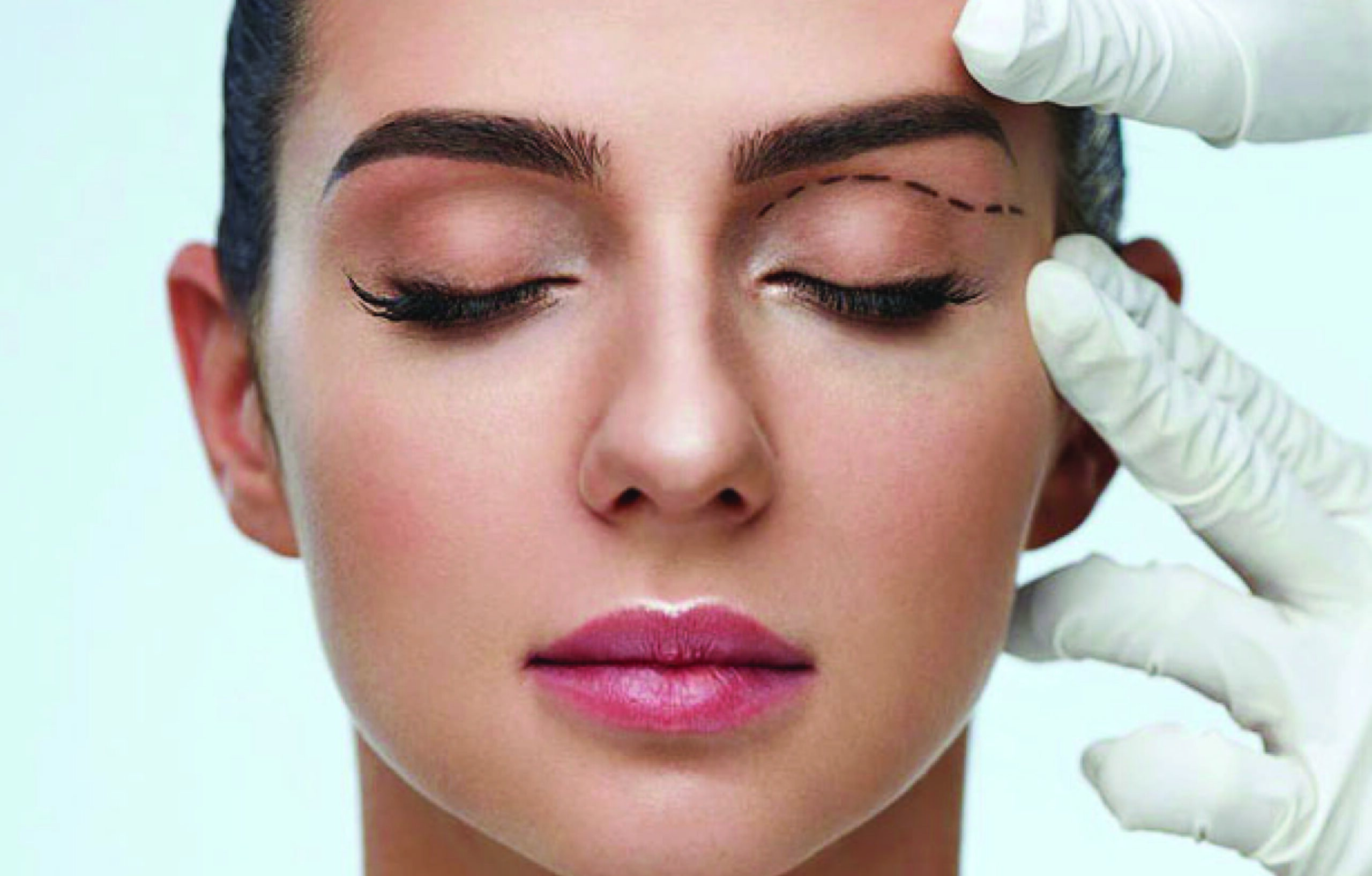 Orbital Decompression